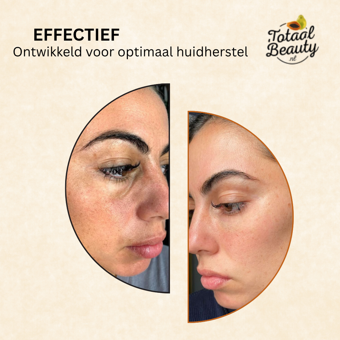 Savon Total Beauty Alpha Arbutine 130 gr