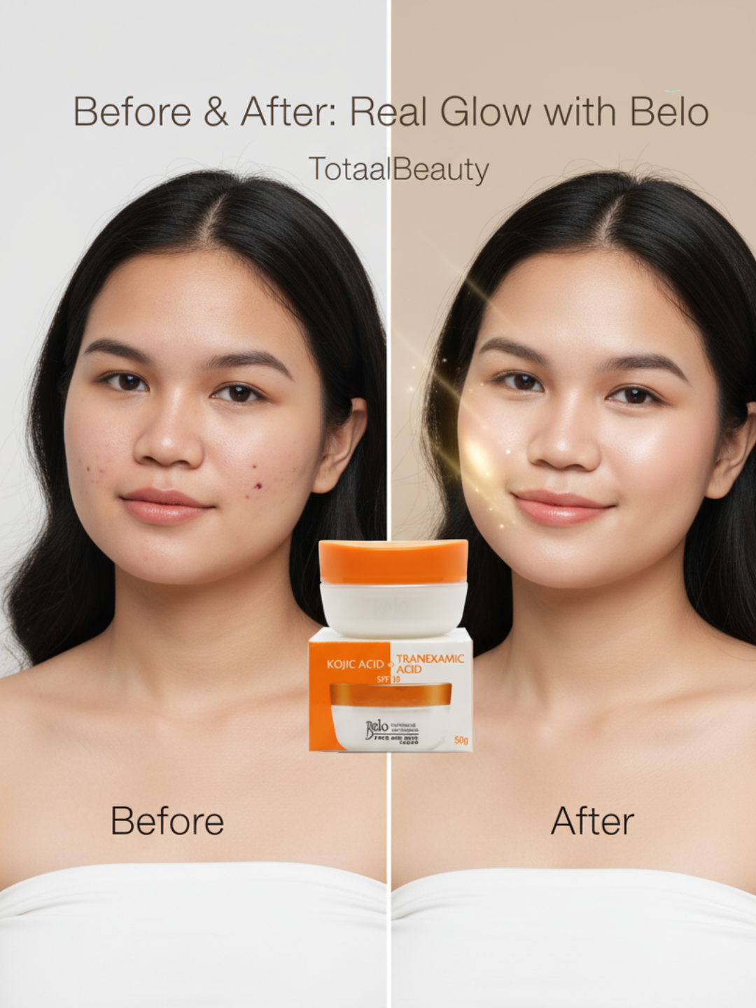 Belo Face & Neck Cream SPF 30 – 50 g – Verhelderende & Beschermende Gezichts- en Nekcrème – Vermindert Donkere Vlekken, Egaliseert de Huidtint & Beschermt tegen UV-stralen – Voor een Gladde, Stralende & Gezonde Teint