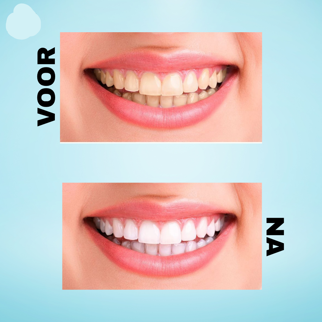 Dentifrice Crest 3D Brilliance White – 121 g (2 pièces) – Tandpasta blanchissant avancé – Verwijdert Oppervlaktevlekken, Verheldert Tanden & Zorgt voor een Stralend Witte, Gezonde Glimlach