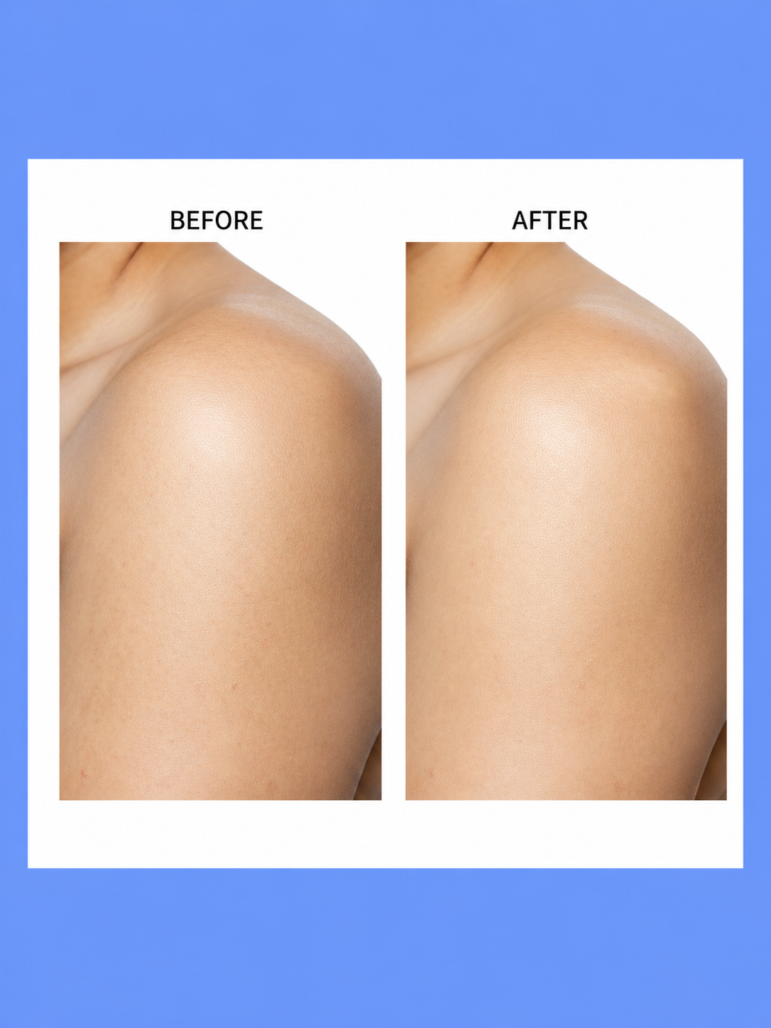 Belo Skin Lightening Underarm Cream – 40 g + Classic Soap – Verhelderende & Verzorgende Set – Helpt Donkere Oksels te Verminderen, Egaliseert de Huidtint & Hydrateert – Voor Zachte, Frisse & Stralende Okselhuid