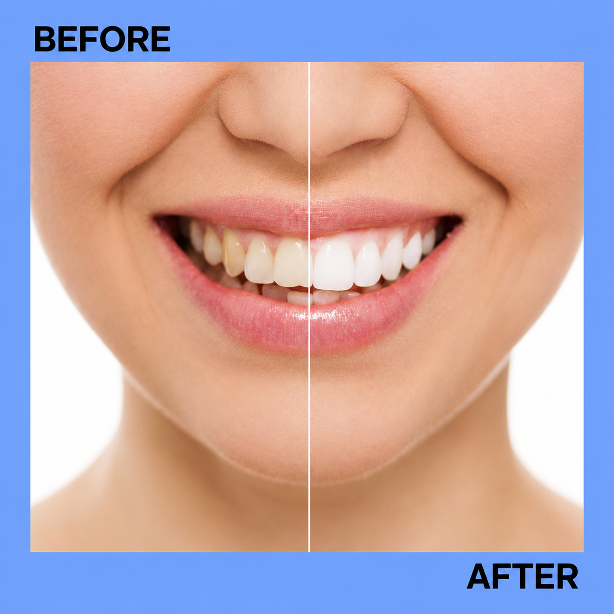 Crest 3D White Brilliance Deep Stain Remover – Groot formaat – Nieuw in Nederland – Verwijdert Diepe Tanden Vlekken, Verheldert Tanden & Beschermt Tandglazuur – Voor een Stralende, Witte & Gezonde Glimlach