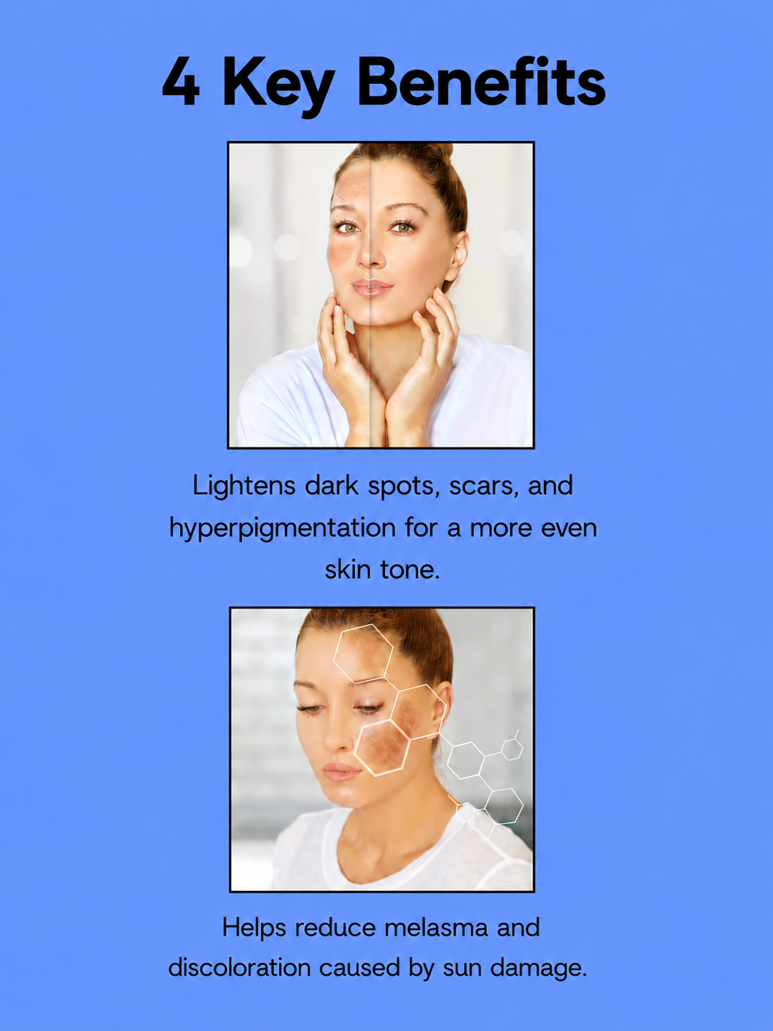 Kojie San Skin Lightening Face Cream SPF 15 – 22 g – Verhelderende & Beschermende Gezichtscrème – Verminderde Donkere Vlekken, Egaliseert de Huidtint & Beschermt tegen UV-stralen – Voor een Gladde, Stralende & Gezonde Teint