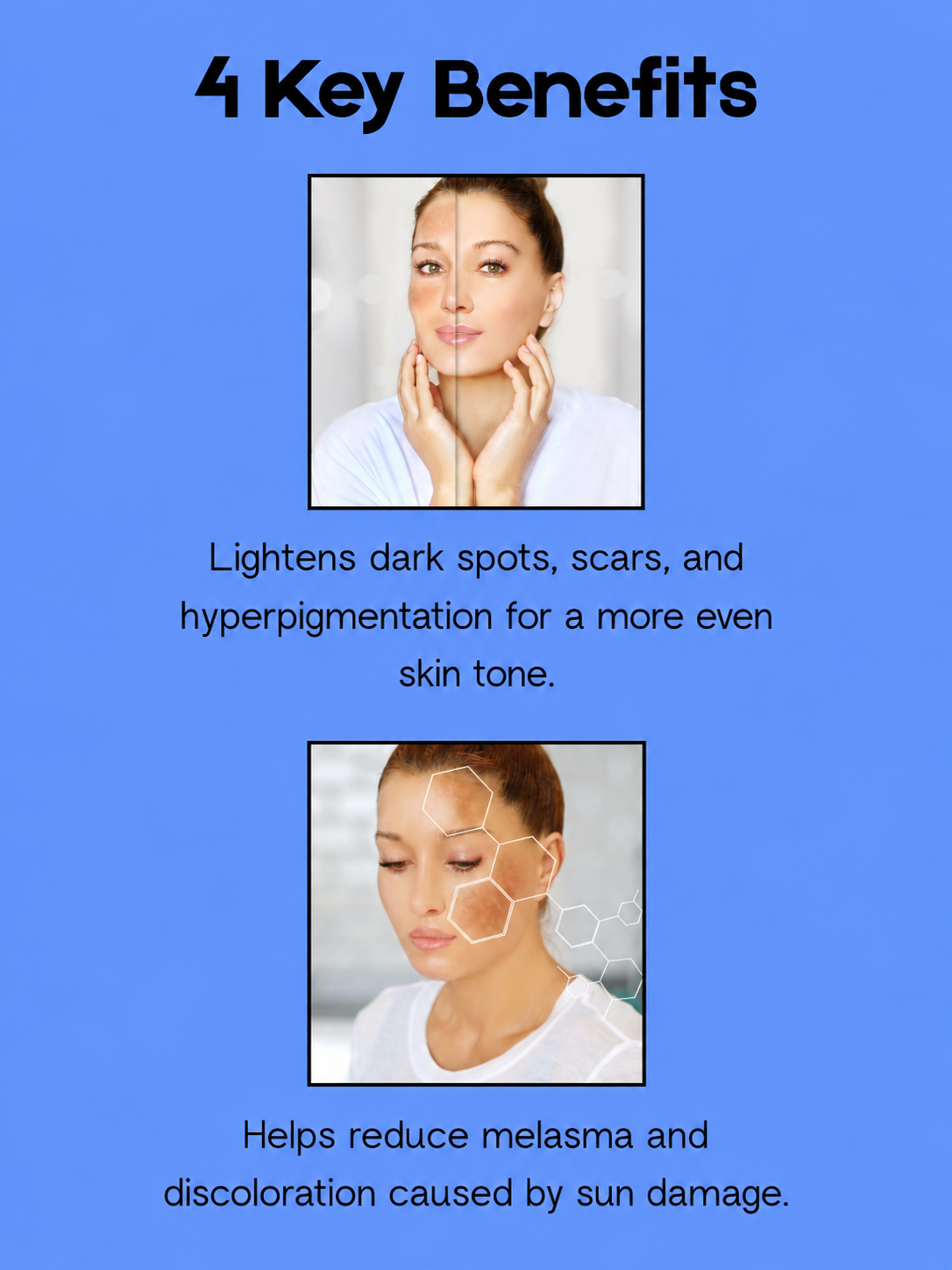 Kojie San Skin Whitening Soap + Skin Lightening Cleanser + Toner – Verhelderende & Hydraterende Huidverzorgingsset – Verminderde Donkere Vlekken, Egaliseert de Huidtint & Hydrateert Intensief – Voor een Gladde, Stralende & Gezonde Huid