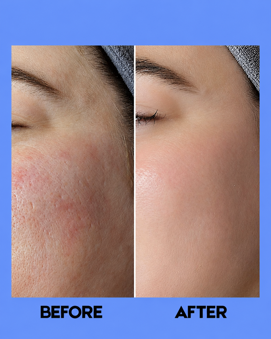 Kojie San Skin Lightening Pore Minimizing Toner – 100 ml – Verhelderende & Verfijnende Huidverzorging – Helpt Poriën te verminderen, Donkere Vlekken te Reduceren & Egaliseert de Huidtint – Voor een Gladde, Stralende & Gezonde Huid