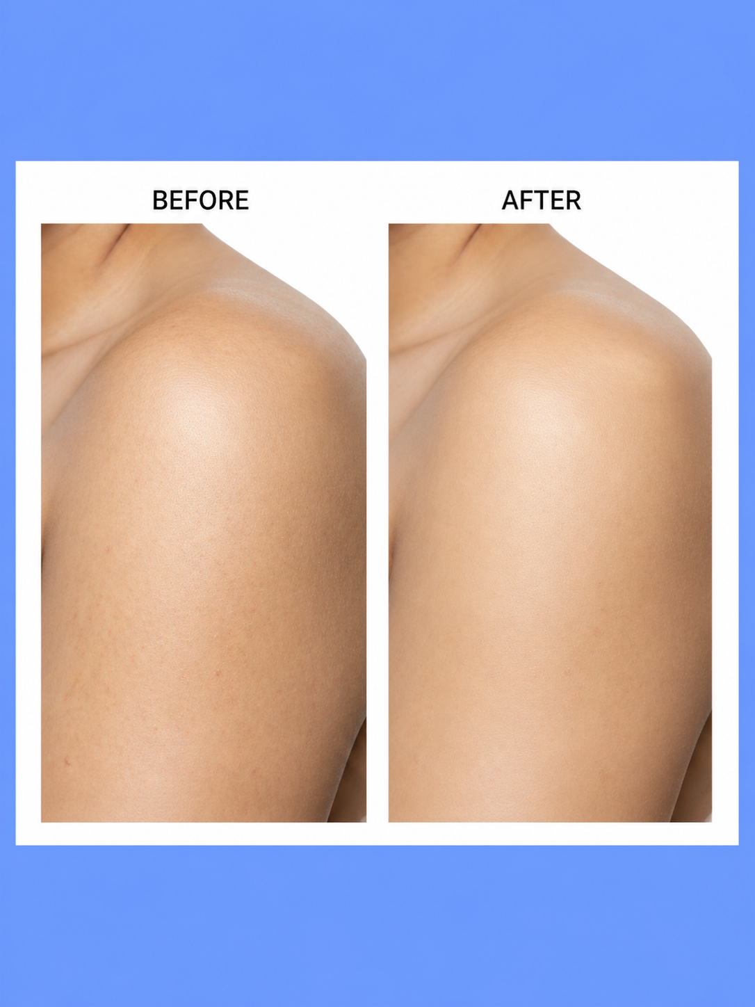 Belo Voordeelpakket – Bodylotion 200 ml + Zeep 65 g – Verhelderende & Hydraterende Set – Verminderde Donkere Vlekken, Egaliseert de Huidtint & Hydrateert Intensief – Voor een Gladde, Stralende & Gezonde Huid
