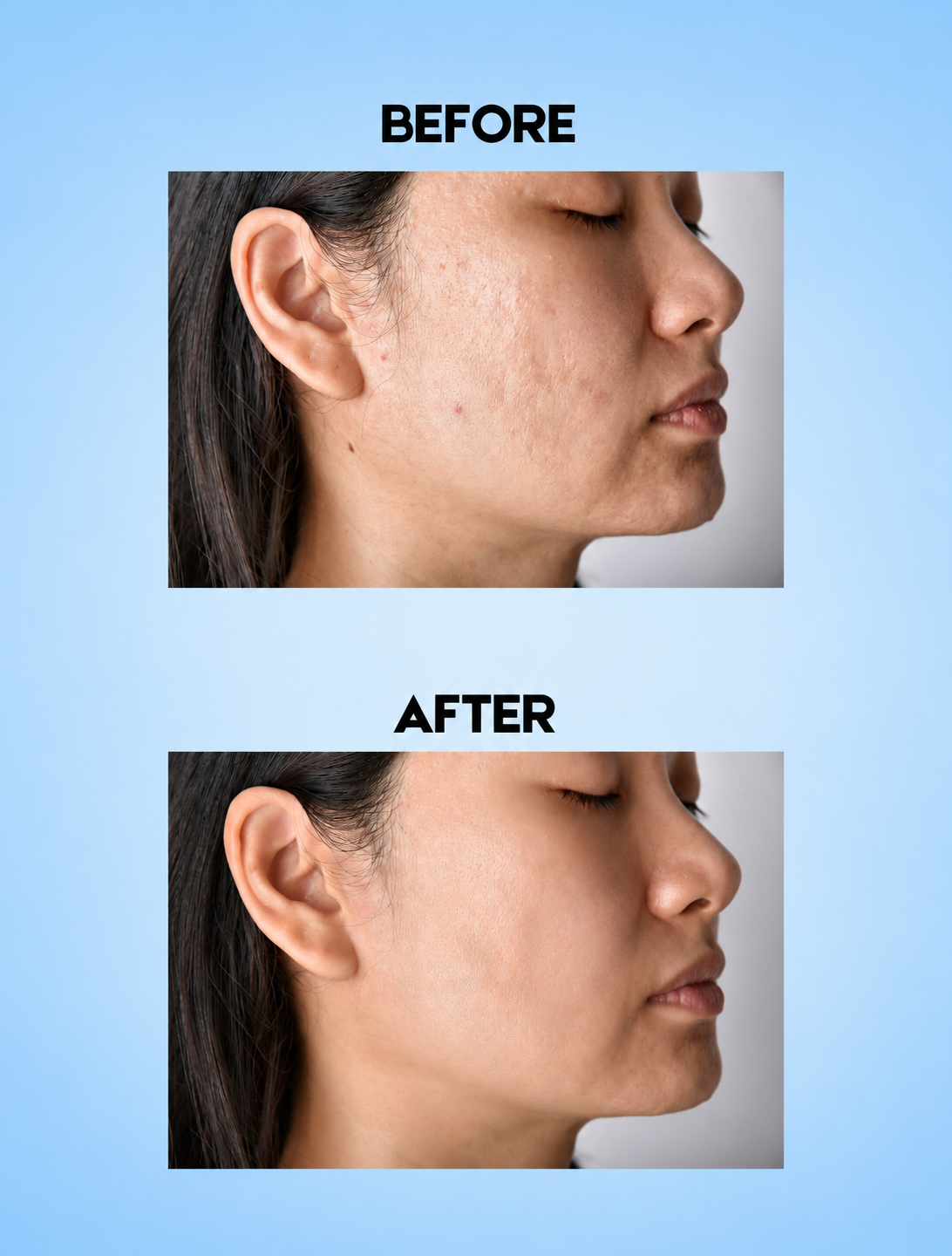 Alada Skin Lightening Zeep – 80gr – Tegen Pigmentvlekken – Donkere Vlekken Verwijderaar – Egale Huid – Whitening Gezichts- & Lichaamszeep – Natuurlijke Ingrediënten – Hydraterend & Verzorgend (Copy)