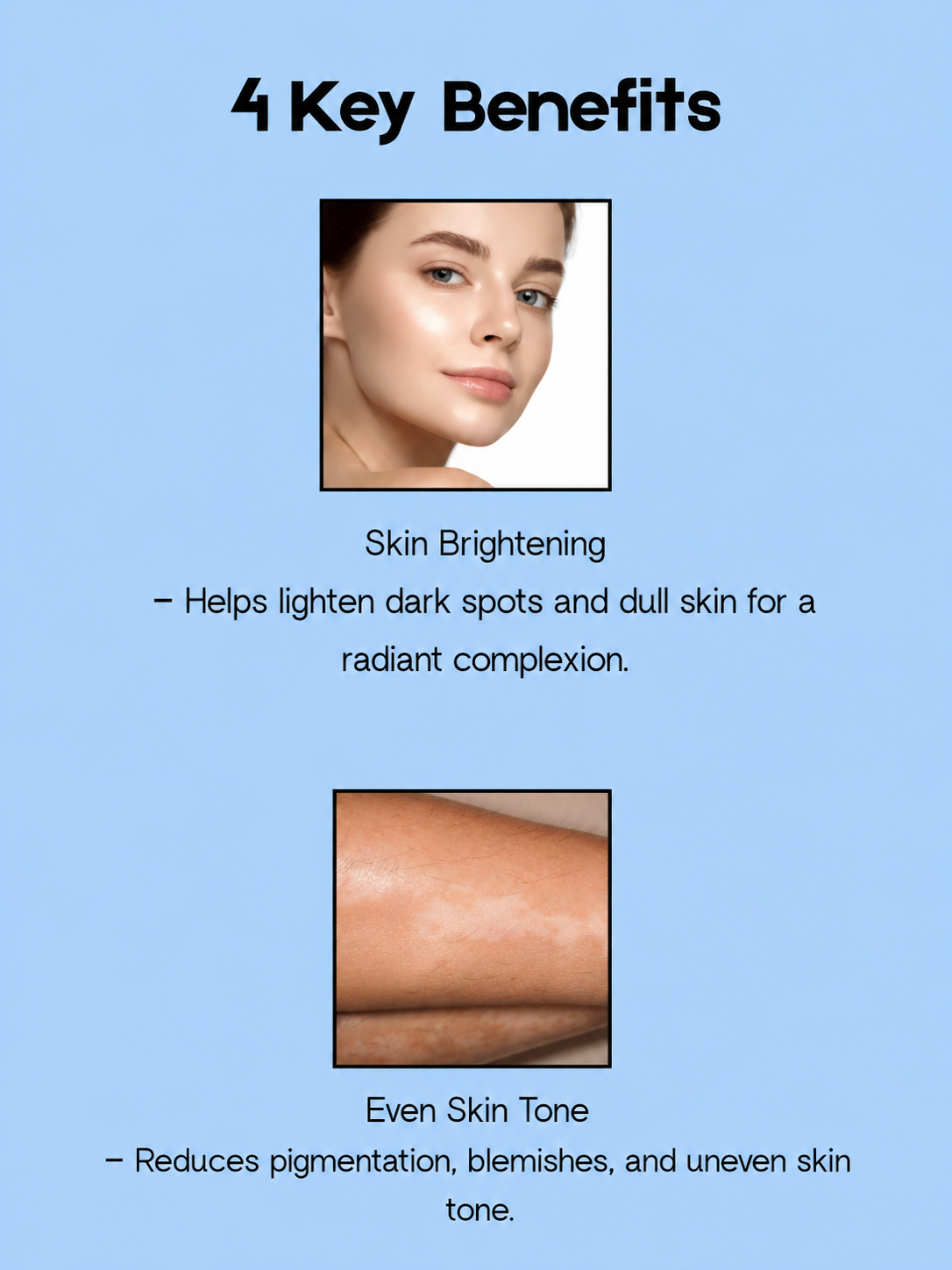 Gluta-C 4× Skin Whitening Acne Control Toner – 100 ml – Verhelderende & Acnebestrijdende Huidverzorging – verminderde Donkere Vlekken, Egaliseert de Huidtint & Helpt Puistjes te Behandelen – Voor een Gladde, Stralende & Gezonde Huid