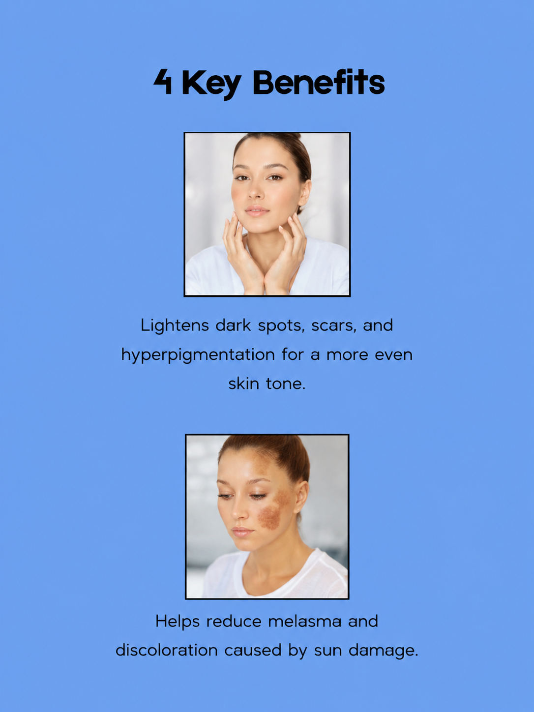 Kojie San Dream White Anti-Aging Facial Toner - 100 ml - Verhelderende & Verjongende Huidverzorging - Vermindert Donkere Vlekken, Egaliseert de Huidtint & Bereidt de Huid Voor op Hydratatie - Voor een Gladde, Stralende & Gezonde Teint