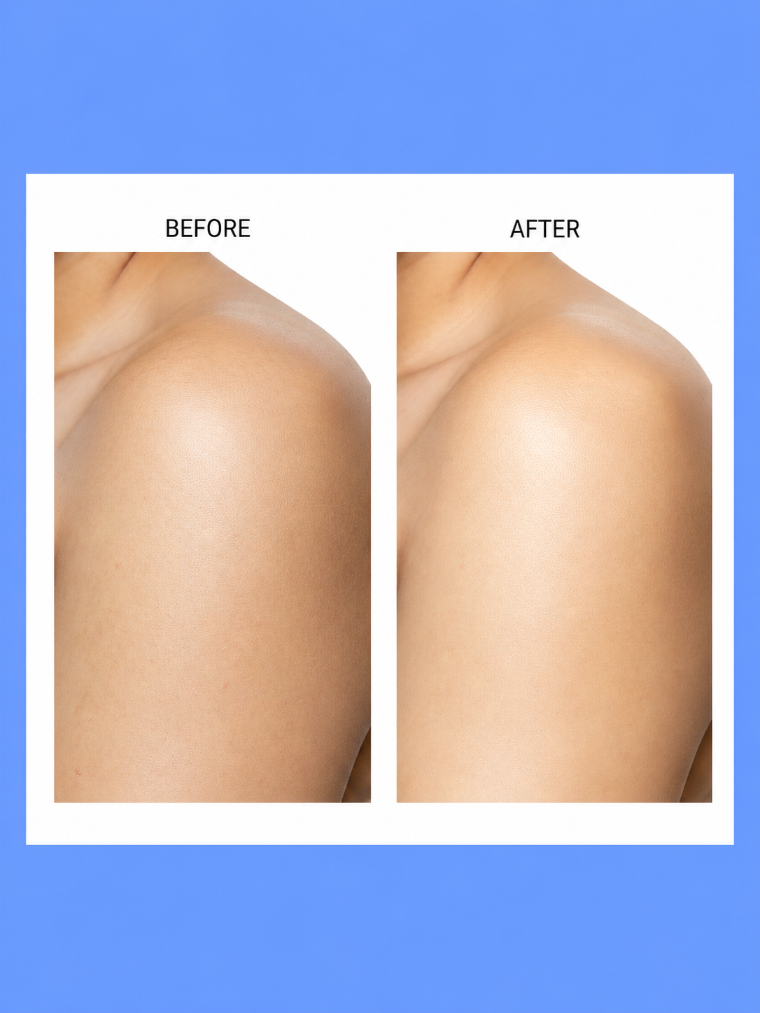 Belo Intensive Whitening Micropeeling Toner + Exfoliating Soap – Verhelderende & Exfoliërende Huidverzorgingsset – Helpt Donkere Vlekken te verminderen, Egaliseert de Huidtint & Verfrist de Huid – Voor een Gladde, Stralende & Gezonde Teint