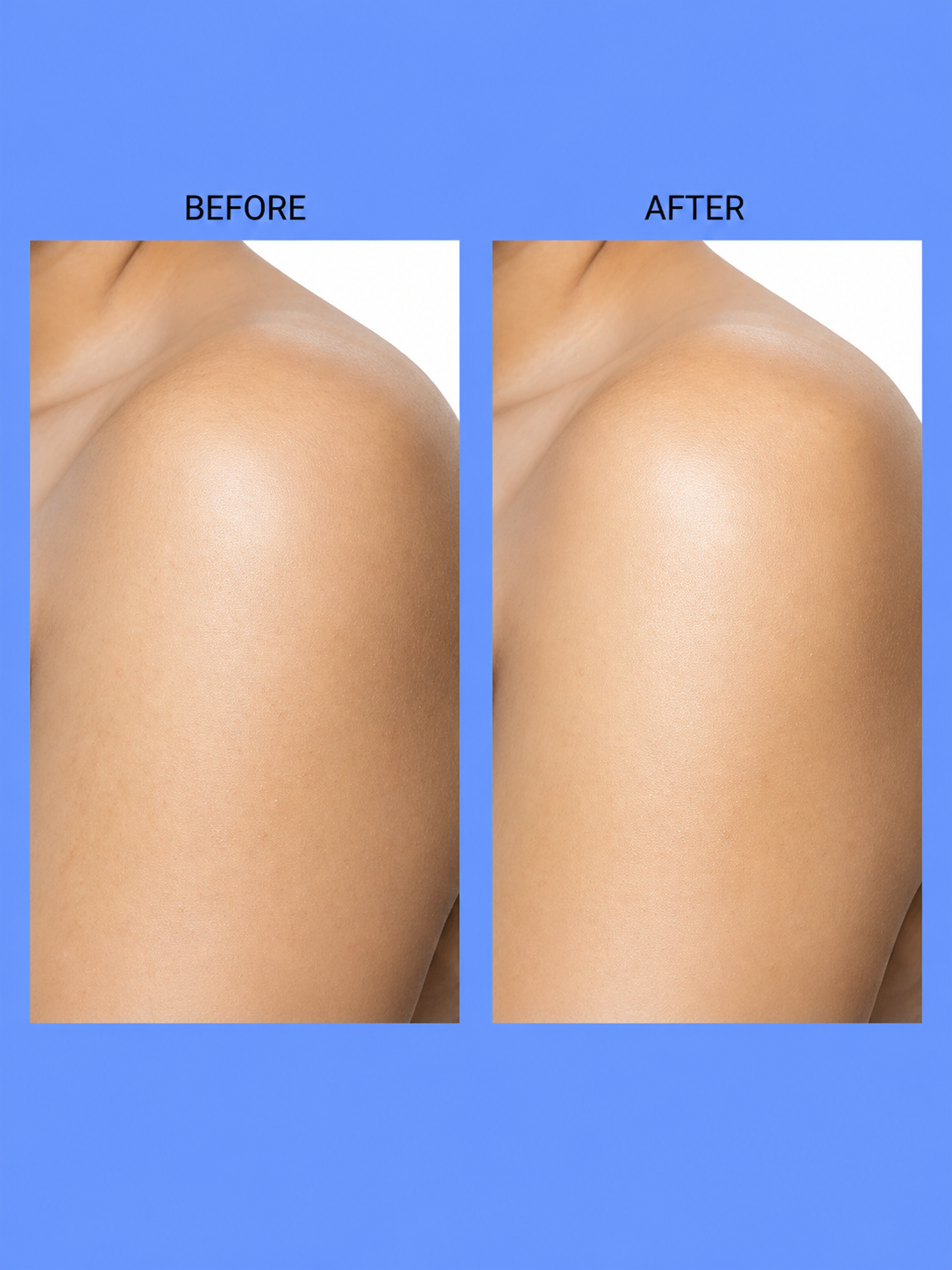 Belo Body Advantage Package – Verhelderende & Hydraterende Body Care Set – Helpt Donkere Vlekken te verminderen, Egaliseert de Huidtint & Voedt Intensief – Voor een Gladde, Stralende & Gezonde Huid