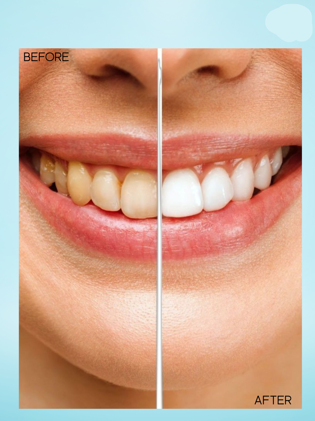 Crest 3D White Hydrogen Peroxide Tandpasta – Groot formaat 107 g – Verwijdert Vlekken, Verheldert Tanden & Beschermt Tandglazuur – Voor Witte, Gezonde Tanden en een Frisse, Stralende Glimlach