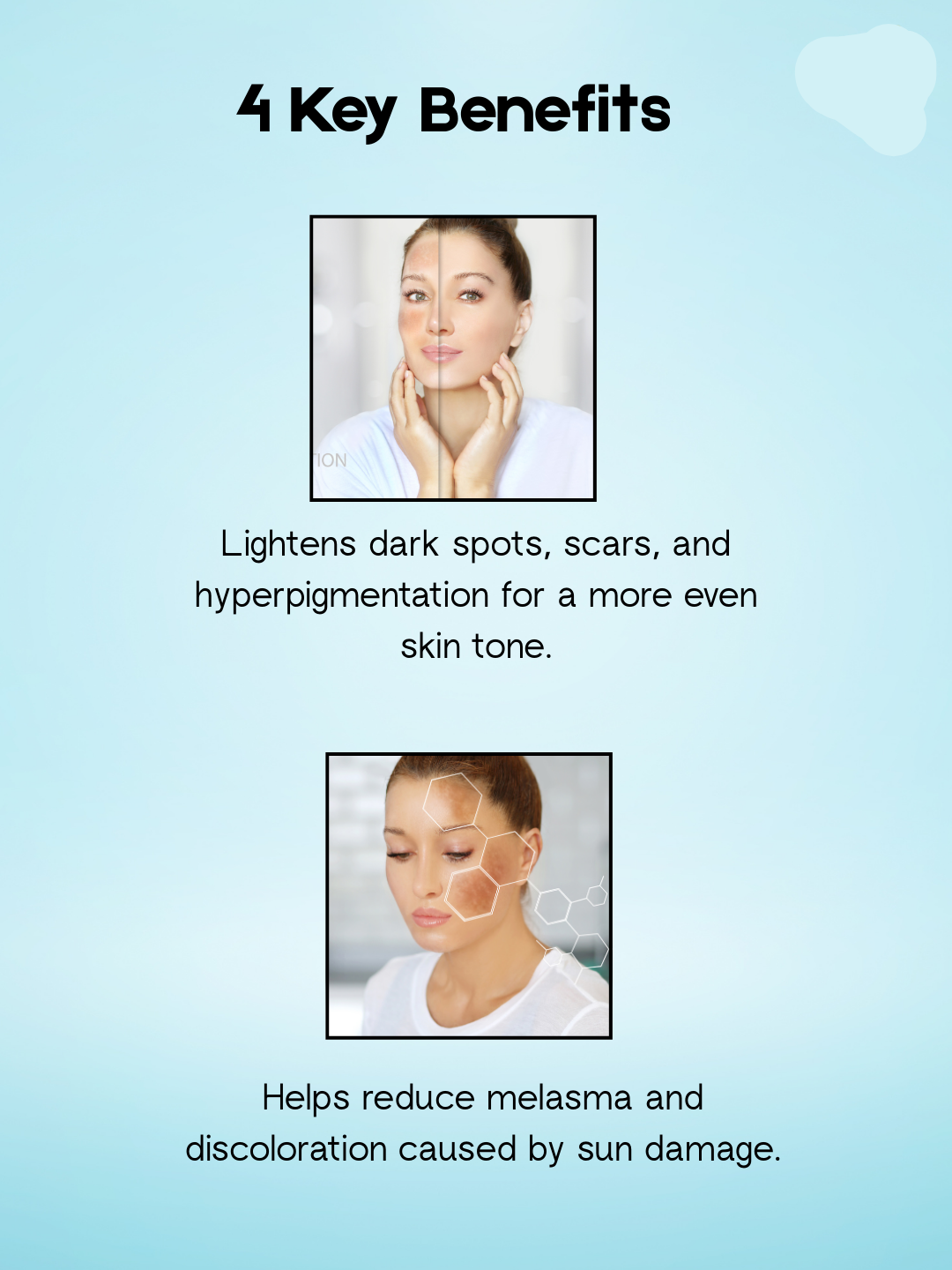 Kojie San Skin Lightening Soap – 3×100 g – Verhelderende & Hydraterende Zeepset – Helpt Donkere Vlekken te verminderen, Egaliseert de Huidtint & Hydrateert Intensief – Voor een Gladde, Stralende & Gezonde Huid