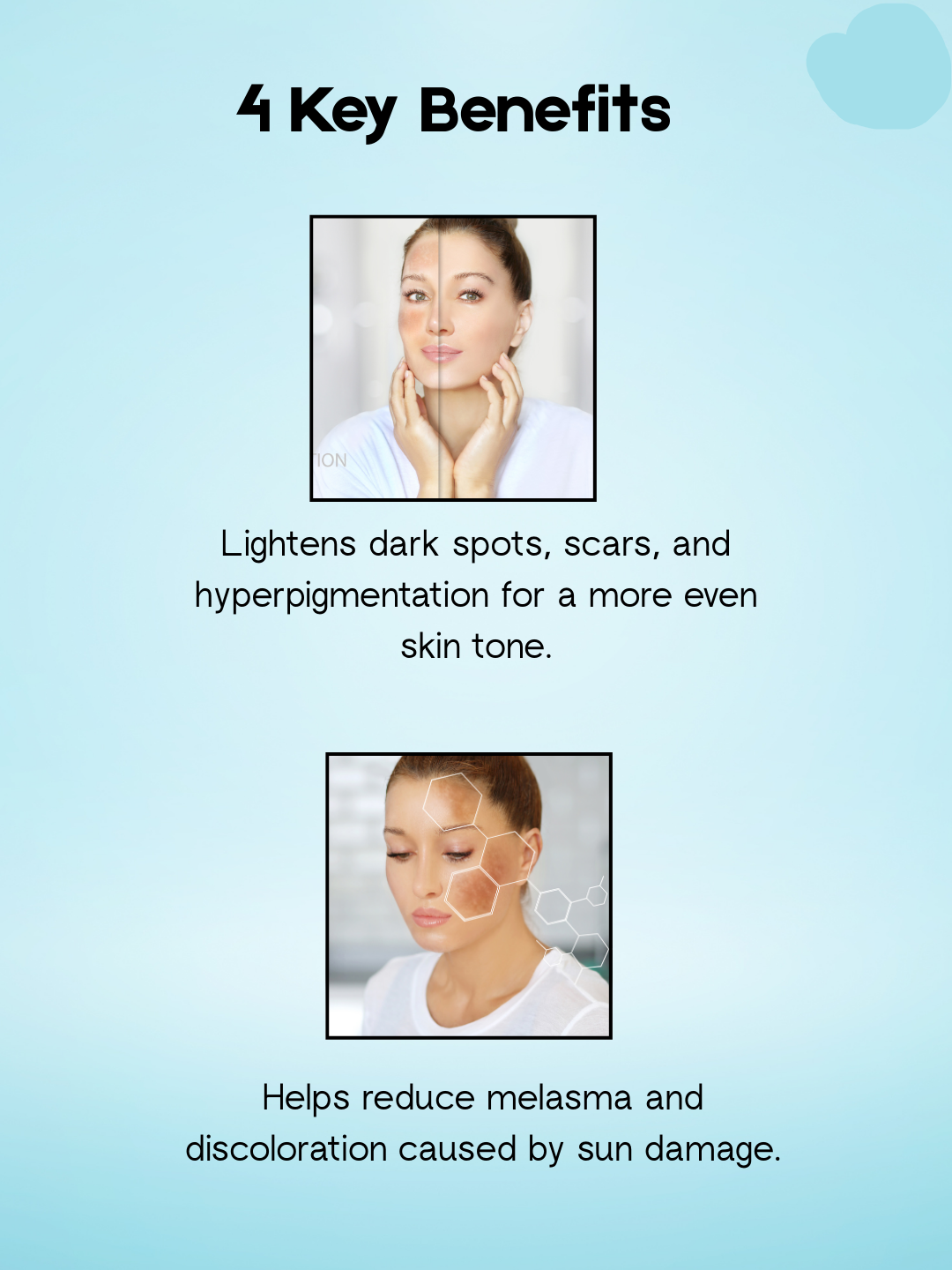 Kojie San Lightening Soap – 3×65 g – Verhelderende & Hydraterende Zeepset – Helpt Donkere Vlekken te verminderen, Egaliseert de Huidtint & Hydrateert Intensief – Voor een Gladde, Stralende & Gezonde Huid