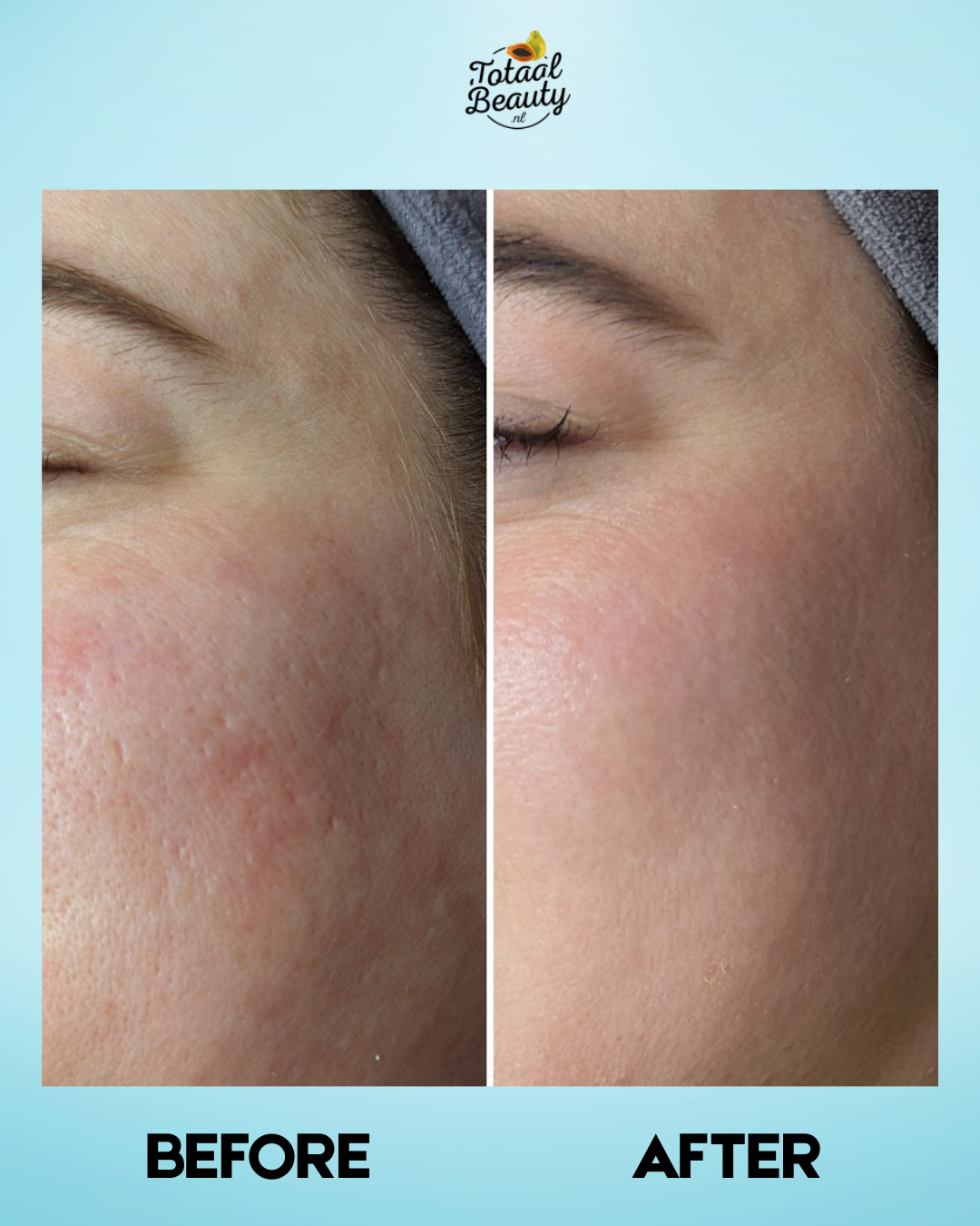 Nettoyant visage en profondeur Eskinol Papaya Smooth Glow