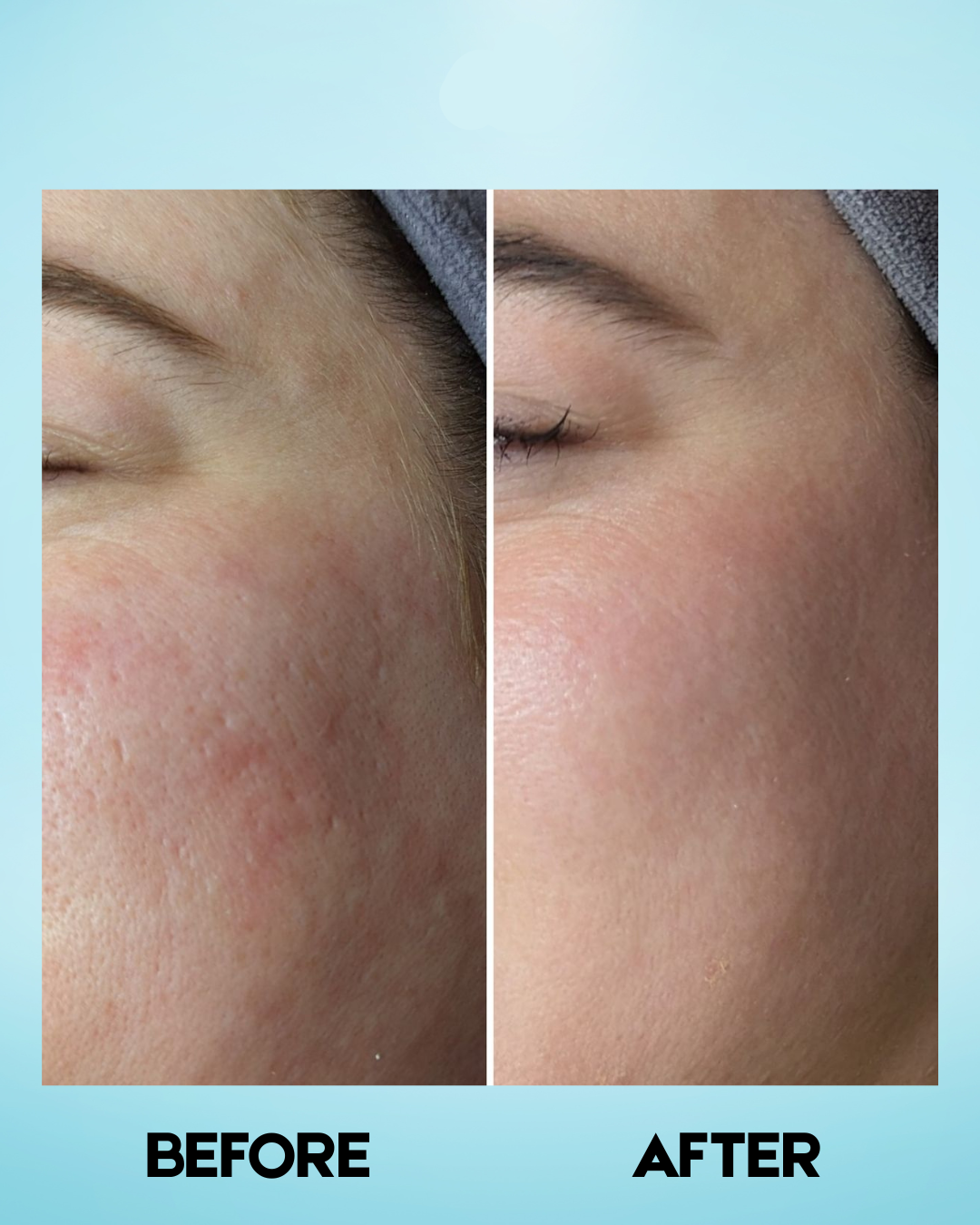 Eskinol Papaya Smooth Glow Facial Deep Cleanser 225 ml – Diep Reinigende & Verhelderende Gezichtsreiniger – Verwijdert Onzuiverheden, Exfolieert Dode Huidcellen & Egaliseert de Huidtint – Voor een Gladde, Stralende & Gezonde Teint