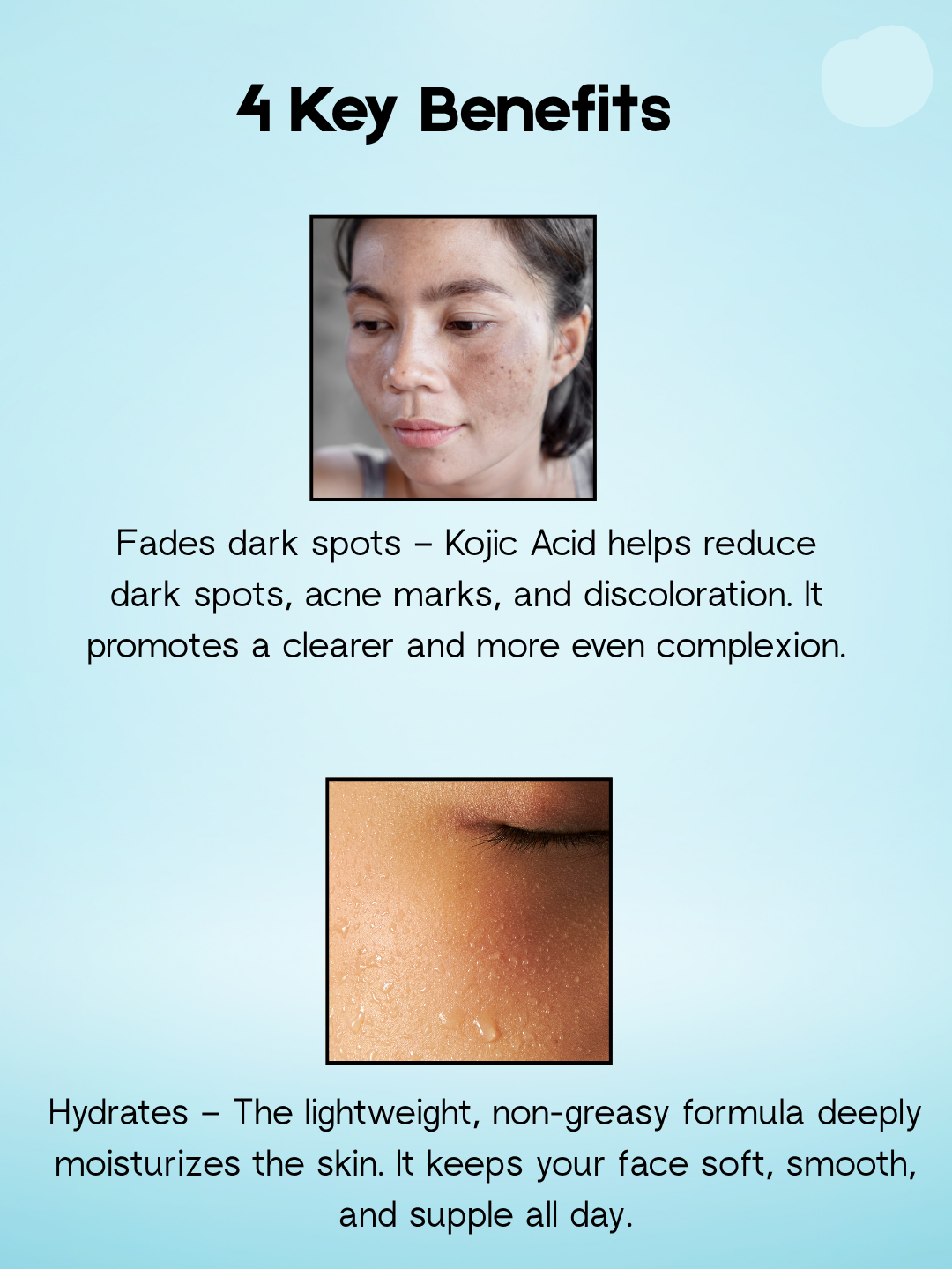 Kojie San Skin Lightening Face Cream – 30 g – Hydraterende Gezichtscrème – Vermindert Donkere Vlekken, Egaliseert de Huidtint & Hydrateert Intensief – Voor een Gladde, Stralende & Gezonde Teint