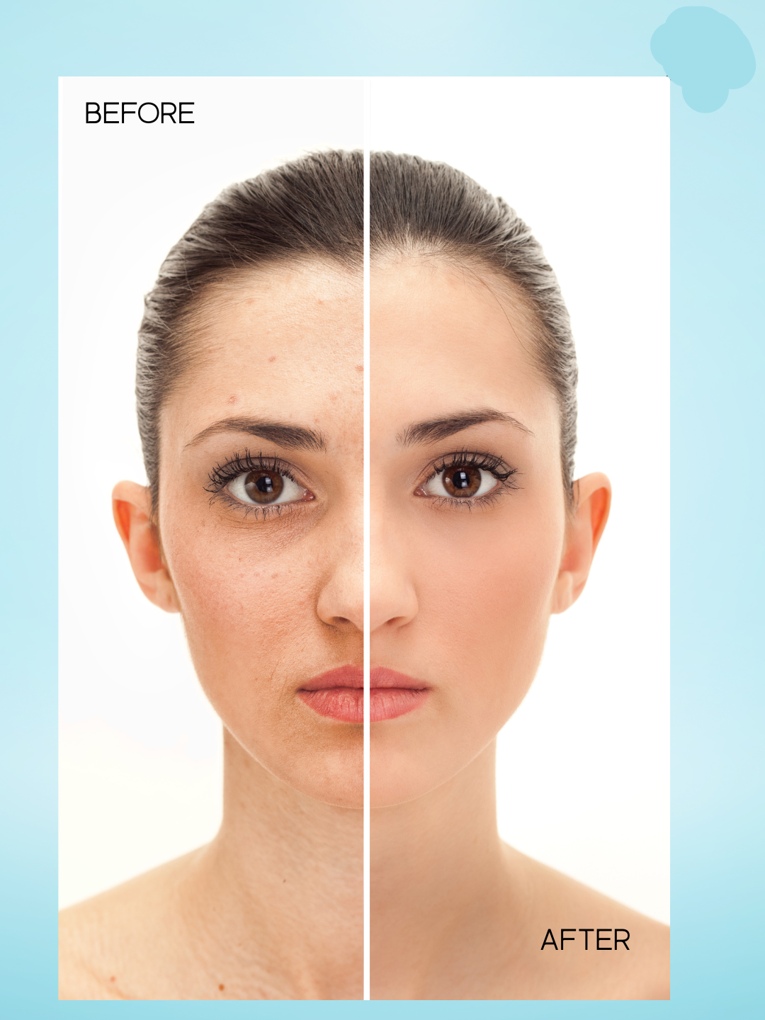 Kojie San Skin Lightening Face Cream – 30 g – Hydraterende Gezichtscrème – Vermindert Donkere Vlekken, Egaliseert de Huidtint & Hydrateert Intensief – Voor een Gladde, Stralende & Gezonde Teint