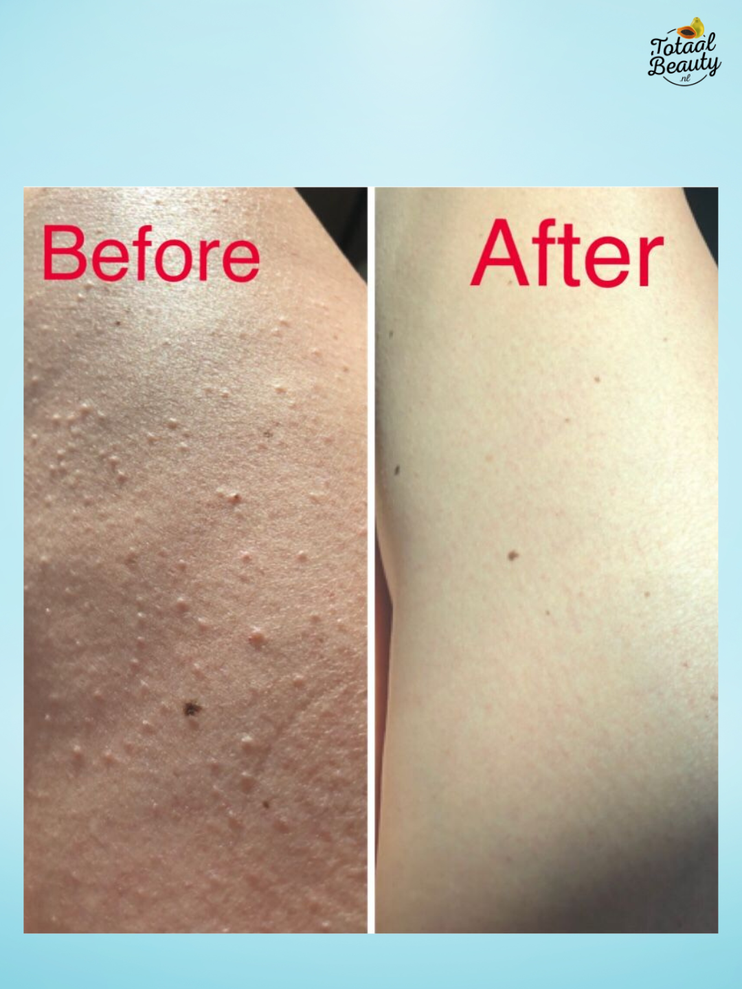 HYA Whitening Booster Serum