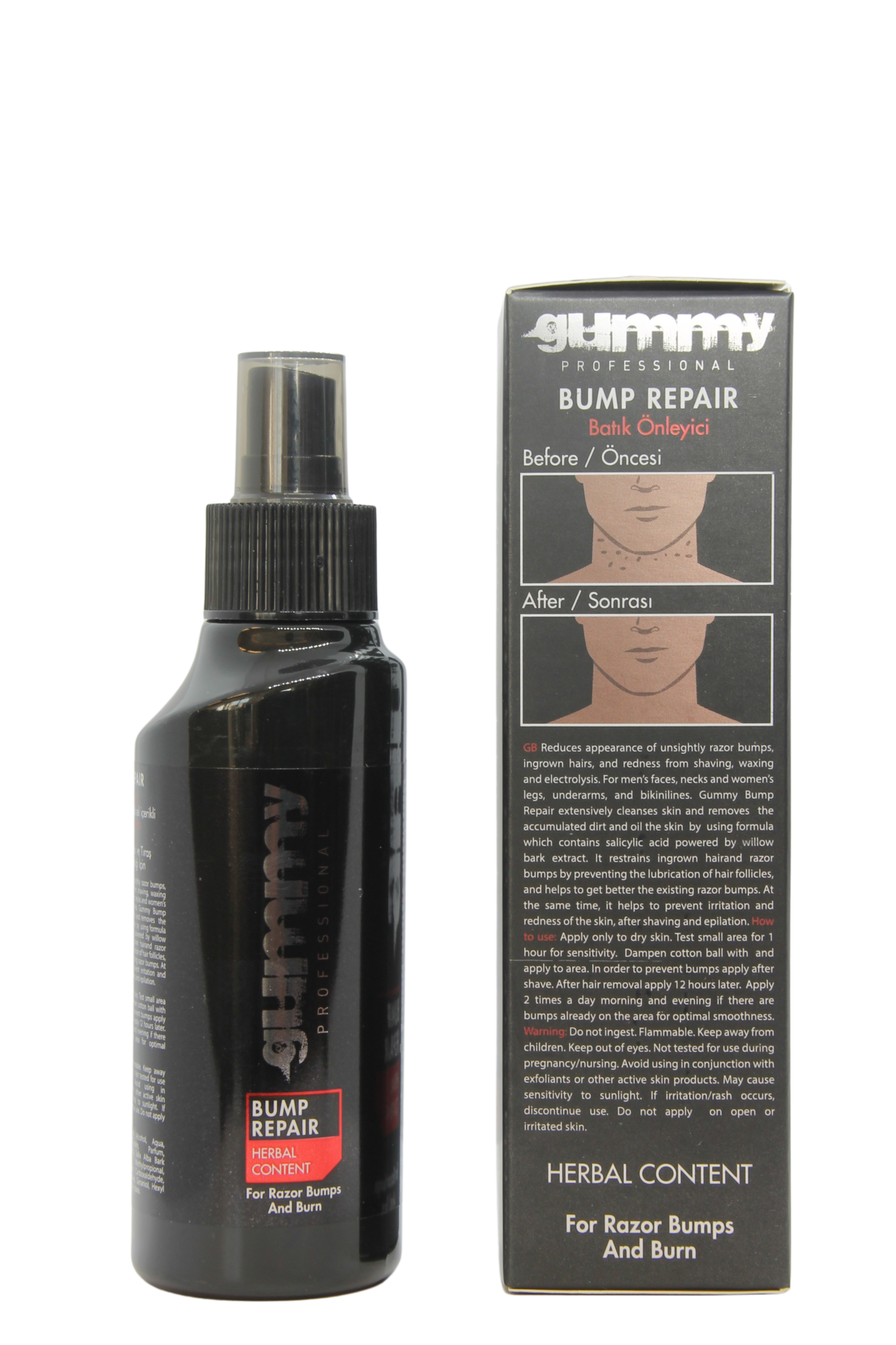 Gummy Professional Bump Repair – 100 ml – Intensieve Huidherstellende Gel – Helpt Onregelmatigheden, Puistjes & Rode Bultjes te Verzachten, Vermindert Irritatie & Bevordert een Egalere Huid – Voor een Gladde, Soepele & Gezonde Teint