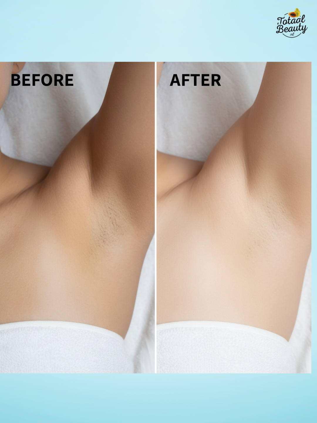 Belo Intense White huidverlichtende deodorantroller 40ml