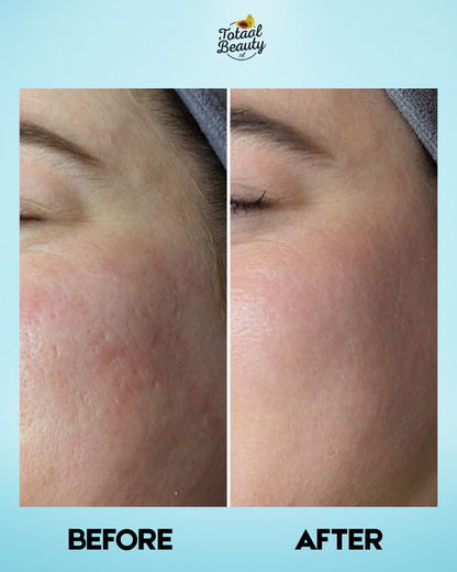 Belo Intensieve Whitening Micropeeling toner 100ml