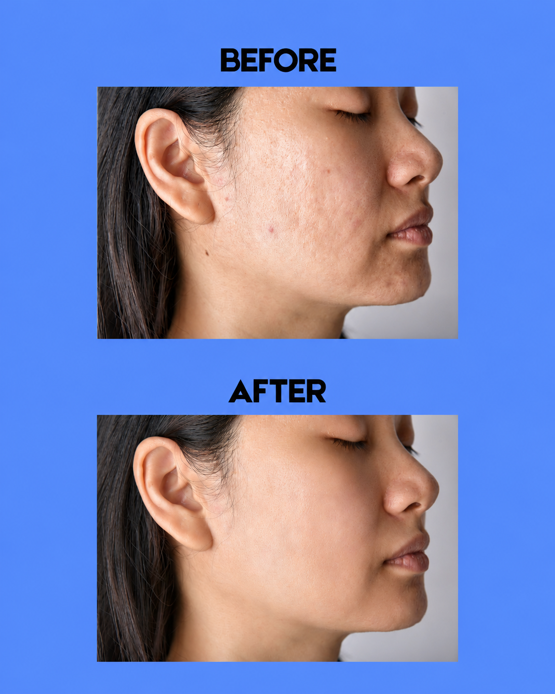 Alada Skin Lightening Zeep – 160g – Tegen Pigmentvlekken – Donkere Vlekken Verwijderaar – Egale Huid – Whitening Gezichts- &amp;amp; Lichaamszeep – Natuurlijke Ingrediënten – Hydrateren &amp;amp; Verzorgend