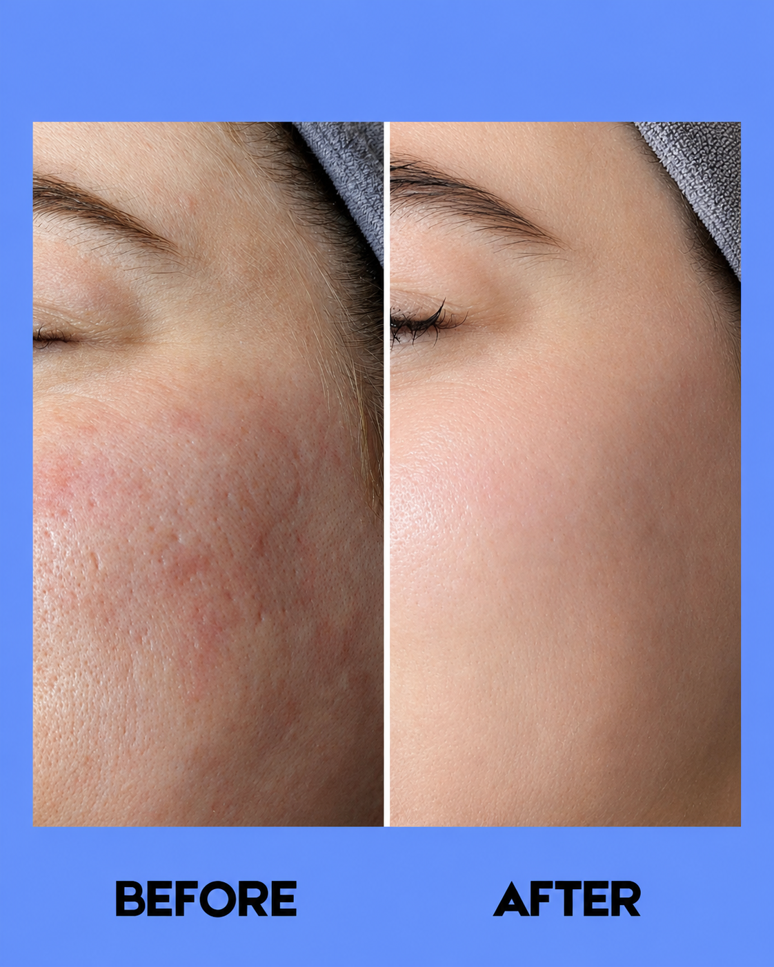 Dr. Alvin Rejuvenating Set No.5 – Complete Huidverzorgingsset – Hydrateert, Verjongt &amp;amp; Verfrist de Huid – Verminderde Fijne Lijntjes, Egaliseert de Huidtint &amp;amp; Geeft een Stralende, Gladde &amp;amp; Gezonde Teint