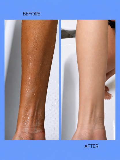 Kojie San Lotion éclaircissante pour le corps SPF 25 – 250 g + savon – Ensemble de soins corporels complets et hydratants – Beschermt tegen UV, Vermindert Donkere Vlekken &amp;amp; Egaliseert de Huidtint – Voor een Gladde, Stralende &amp;amp; Gezonde Huid