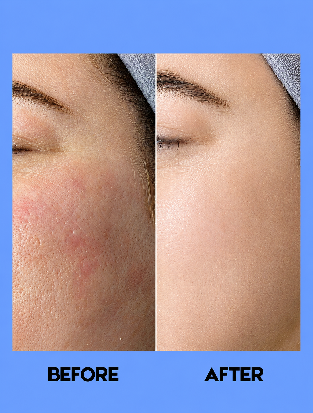 Eskinol Papaya Smooth Glow Facial Deep Cleanser 135 ml – Diep Reinigende &amp; Verhelderende Gezichtsreiniger – Verwijdert Onzuiverheden, Exfolieert Dode Huidcellen &amp; Egaliseert de Huidtint – Voor een Gladde, Stralende &amp; Gezonde Teint