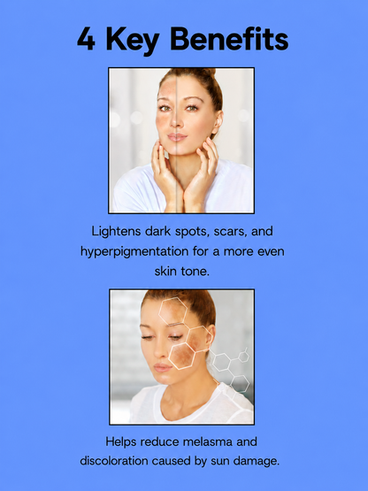 Kojie San Super Serum – 30 ml – Sérum hydratant et hydratant – Aide à nettoyer, égaliser la teinte d&