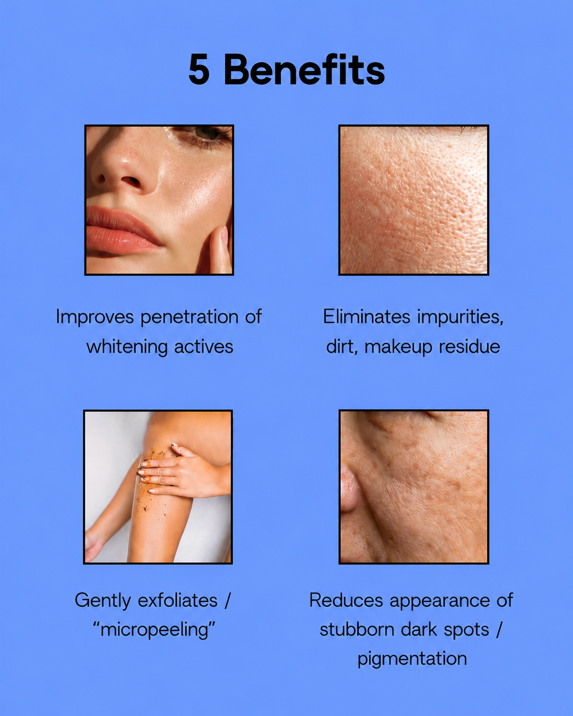 RDL Anti-Acne &amp;amp; Anti-Pigment Babyface Solution No. 2 – Geavanceerde Huidverzorging – Helpt Puistjes te verminderen, Donkere Vlekken te Egaliseren &amp;amp; Ondersteunt een Gladde, Stralende &amp;amp; Gezonde Huid