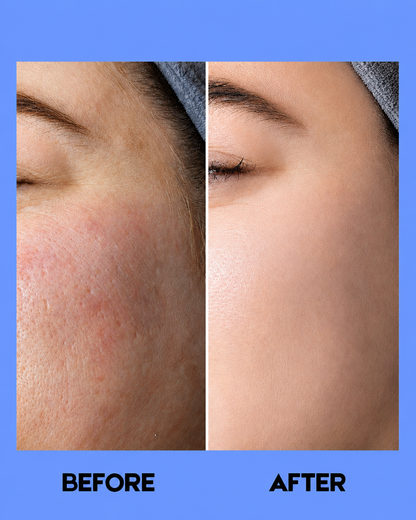 Belo Intensive Whitening Micropeeling Toner – 100 ml – Verhelderende &amp;amp; Exfoliërende Huidtoner – Helpt Donkere Vlekken te verminderen, Egaliseert de Huidtint &amp;amp; Bereidt de Huid Voor op Hydratatie – Voor een Gladde, Stralende &amp;amp; Gezonde Teint