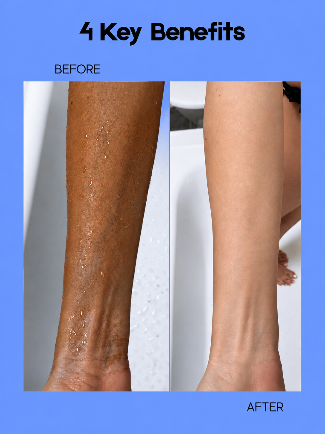 Kojie San Skin Lightening Body Lotion – 200 g – Verhelderende &amp;amp; Hydraterende Body Lotion – Verminderde Donkere Vlekken, Egaliseert de Huidtint &amp;amp; Hydrateert Intensief – Voor een Gladde, Stralende &amp;amp; Gezonde Huid
