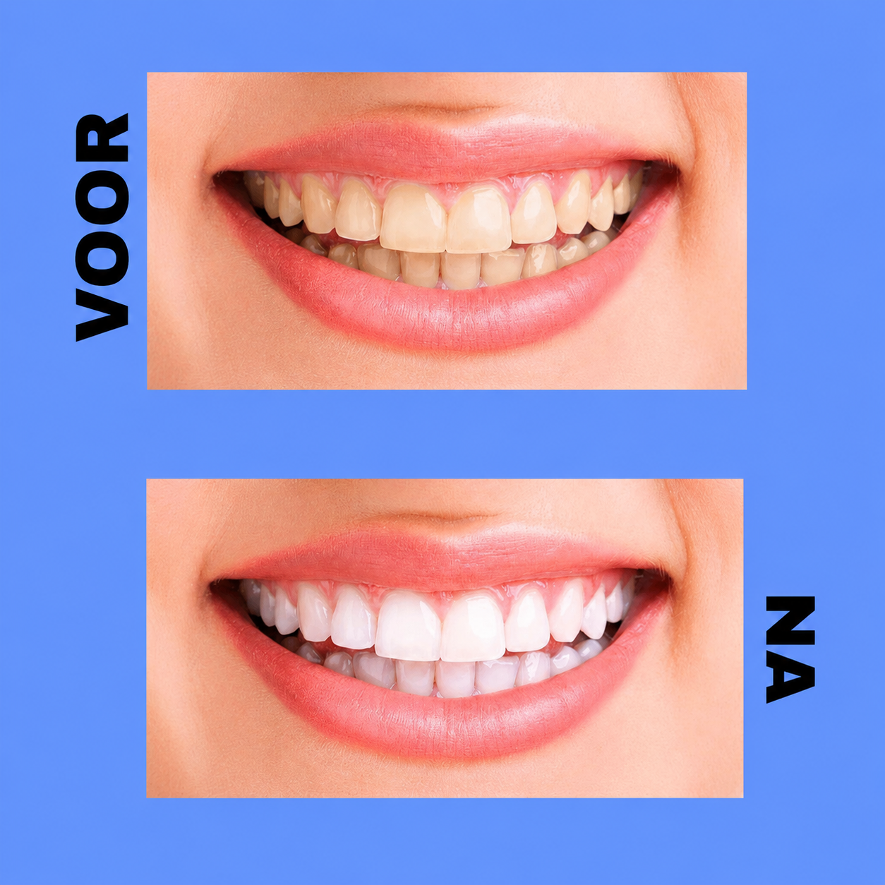 Dentifrice Crest 3D White Brilliance – 121 g – Verwijdert Vlekken, Verheldert Tanden &amp;amp; Beschermt Tandglazuur – Pour Witte, Gezonde Tanden et een Frisse, Stralende Glimlach