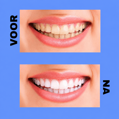Dentifrice Crest 3D White Brilliance – 121 g – Verwijdert Vlekken, Verheldert Tanden &amp;amp; Beschermt Tandglazuur – Pour Witte, Gezonde Tanden et een Frisse, Stralende Glimlach