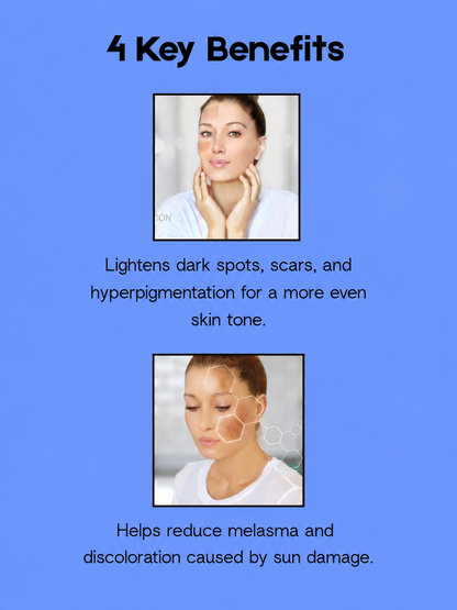 Kojie San Skin Whitening Soap + Skin Lightening Cleanser + Toner – Verhelderende &amp;amp; Hydraterende Huidverzorgingsset – Verminderde Donkere Vlekken, Egaliseert de Huidtint &amp;amp; Hydrateert Intensief – Voor een Gladde, Stralende &amp;amp; Gezonde Huid