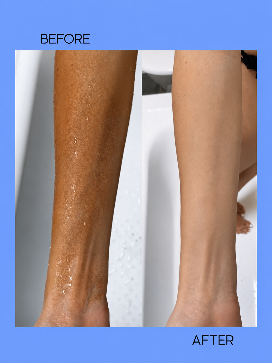 Kojie San Skin Lightening Soap + Face Cream SPF 15 – 22 g – Verhelderende &amp;amp; Beschermende Huidverzorgingsset – Verminderde Donkere Vlekken, Egaliseert de Huidtint &amp;amp; Beschermt tegen UV-stralen – Voor een Gladde, Stralende &amp;amp; Gezonde Huid