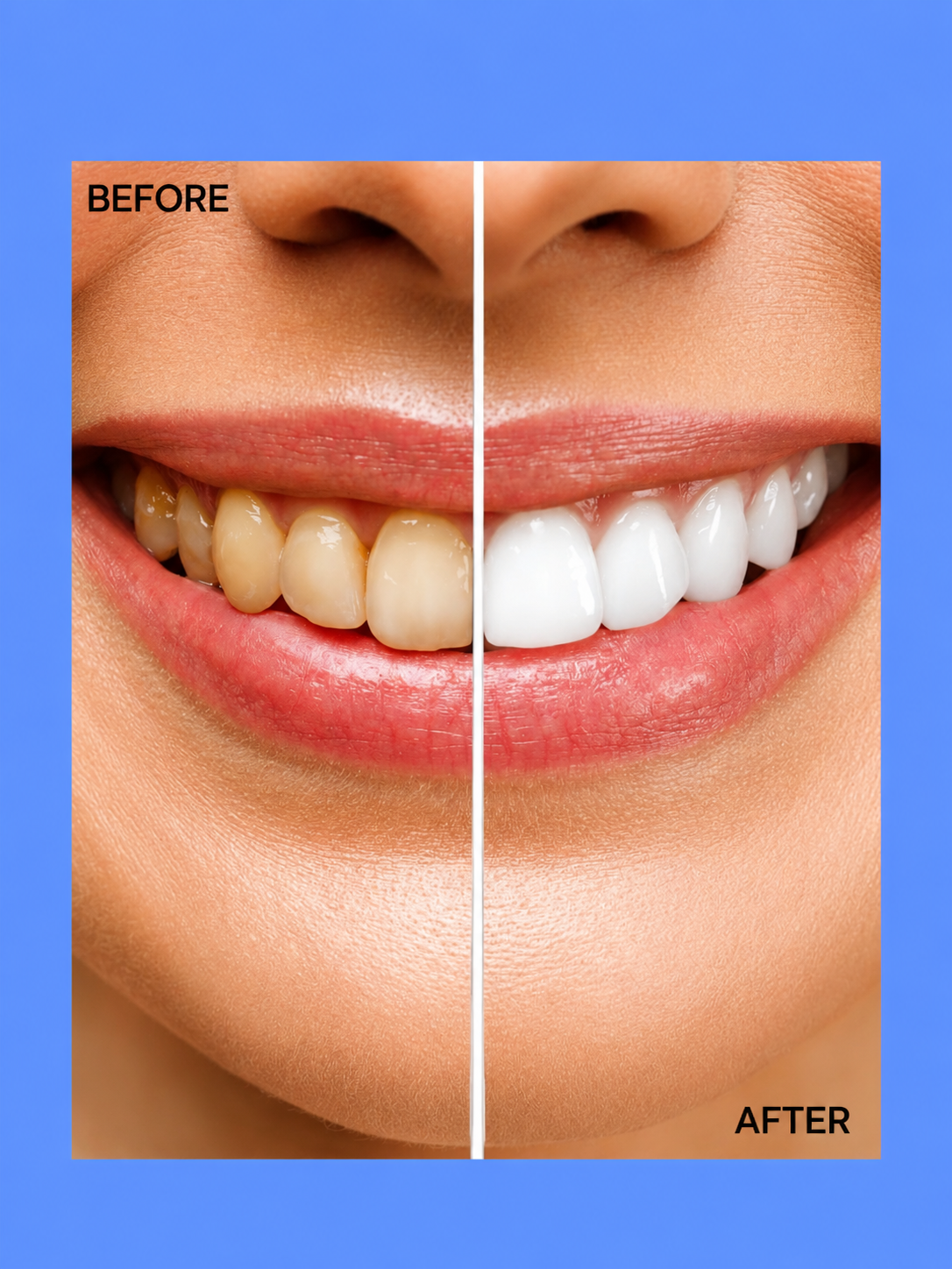 Crest Gum Detoxify &amp;amp; Whitening 2-Step – Gavanceerde tandverzorging die helpt tandplak te verwijderen, het tandvlees te versterken en tanden zichtbaar witter te maken voor een frissere adem and een gezondere, stralende glimlach.