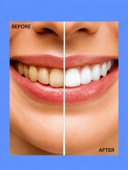 Crest Gum Detoxify &amp;amp; Whitening 2-Step – Gavanceerde tandverzorging die helpt tandplak te verwijderen, het tandvlees te versterken en tanden zichtbaar witter te maken voor een frissere adem and een gezondere, stralende glimlach.