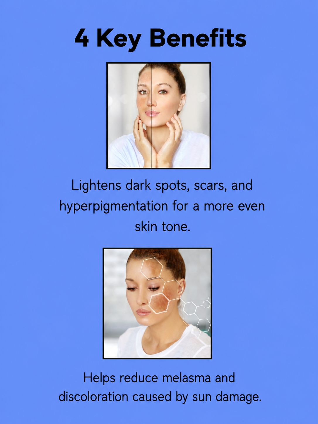 Kojie San Dream White Anti-Aging Facial Toner – 100 ml – Verhelderende &amp; Verjongende Huidverzorging – Vermindert Donkere Vlekken, Egaliseert de Huidtint &amp; Bereidt de Huid Voor op Hydratatie – Voor een Gladde, Stralende &amp; Gezonde Teint