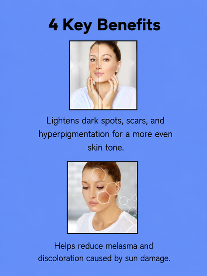 Kojie San Dream White Anti-Aging Facial Toner – 100 ml – Verhelderende &amp; Verjongende Huidverzorging – Vermindert Donkere Vlekken, Egaliseert de Huidtint &amp; Bereidt de Huid Voor op Hydratatie – Voor een Gladde, Stralende &amp; Gezonde Teint