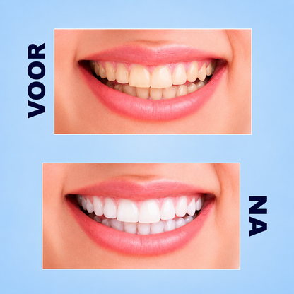 Dentifrice Crest 3D Brilliance White – 121 g (2 pièces) – Tandpasta blanchissant avancé – Verwijdert Oppervlaktevlekken, Verheldert Tanden &amp;amp; Zorgt voor een Stralend Witte, Gezonde Glimlach