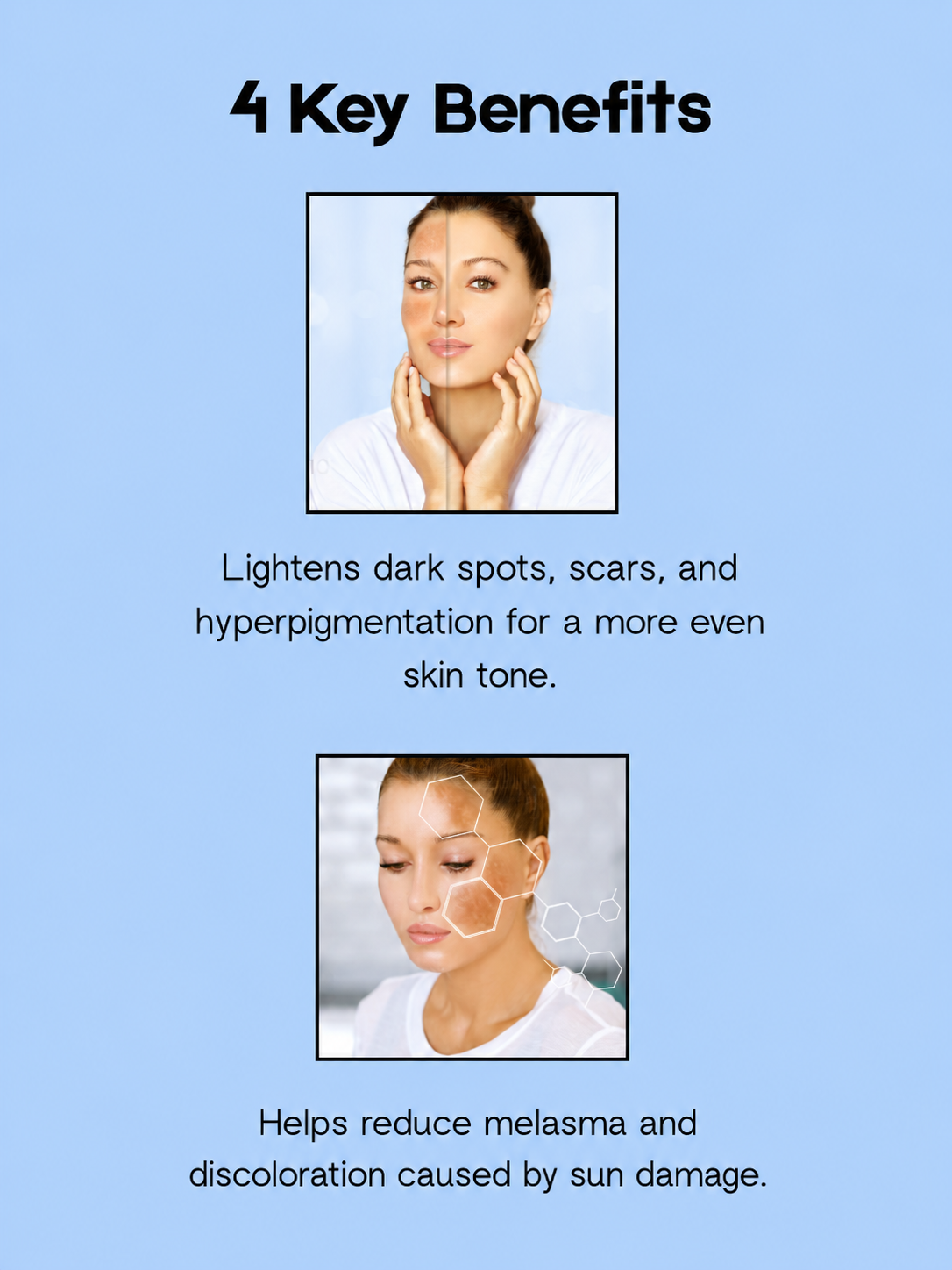 Kojie San Skin Lightening Face Cream SPF 15 – 22 g – Verhelderende &amp;amp; Beschermende Gezichtscrème – Vermindert Donkere Vlekken, Egaliseert de Huidtint &amp;amp; Beschermt tegen UV-stralen – Voor een Gladde, Stralende &amp;amp; Gezonde Teint