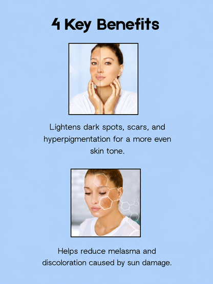 Kojie San Skin Lightening Face Cream SPF 15 – 22 g – Verhelderende &amp;amp; Beschermende Gezichtscrème – Vermindert Donkere Vlekken, Egaliseert de Huidtint &amp;amp; Beschermt tegen UV-stralen – Voor een Gladde, Stralende &amp;amp; Gezonde Teint