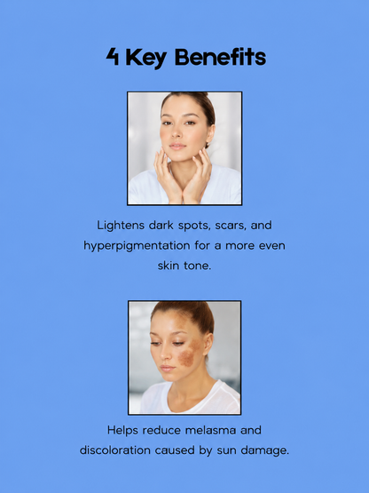 Kojie San Dream White Anti-Aging Facial Toner - 100 ml - Verhelderende &amp;amp; Verjongende Huidverzorging - Vermindert Donkere Vlekken, Egaliseert de Huidtint &amp;amp; Bereidt de Huid Voor op Hydratatie - Voor een Gladde, Stralende &amp;amp; Gezonde Teint