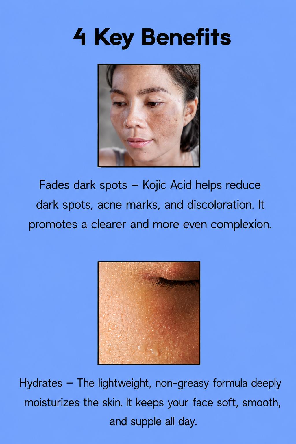 Kojie San Skin Lightening Body Wash – 300 ml – Nettoyant pour le corps polyvalent et régénérant – Aide à nettoyer, égaliser la teinte et l&
