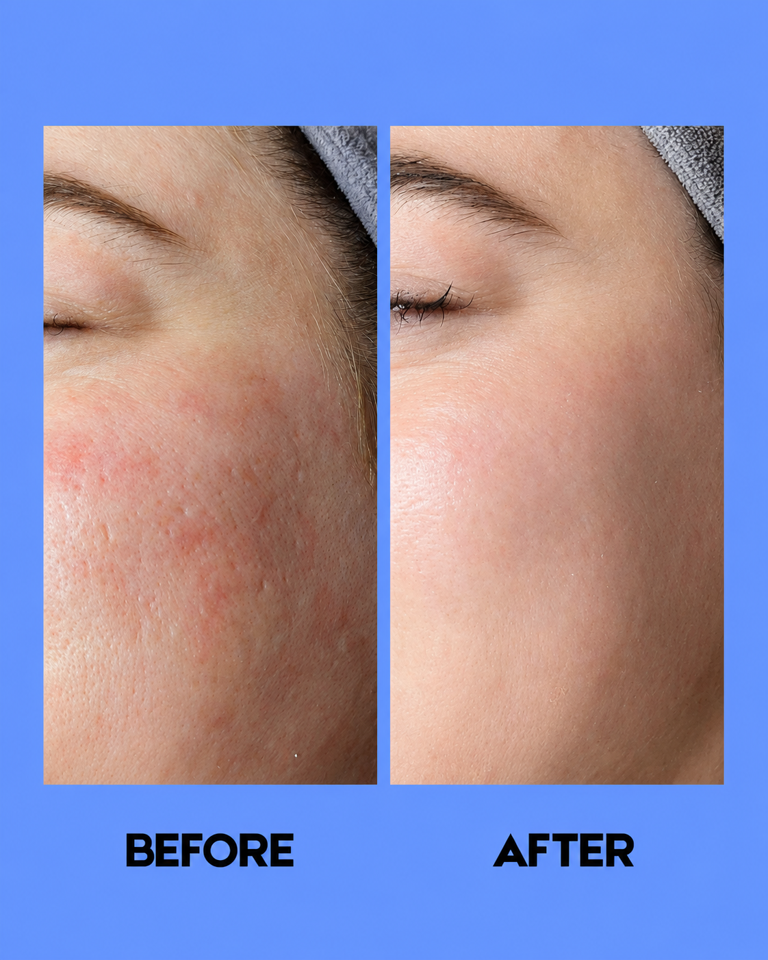 Kojie San Nettoyant et tonique éclaircissant pour la peau – 100 ml – Verhelderende &amp;amp; Hydraterende Huidverzorging – Reinigt Grondig, Verwijdert Onzuiverheden &amp;amp; Egaliseert de Huidtint – Voor een Gladde, Stralende &amp;amp; Gezonde Huid