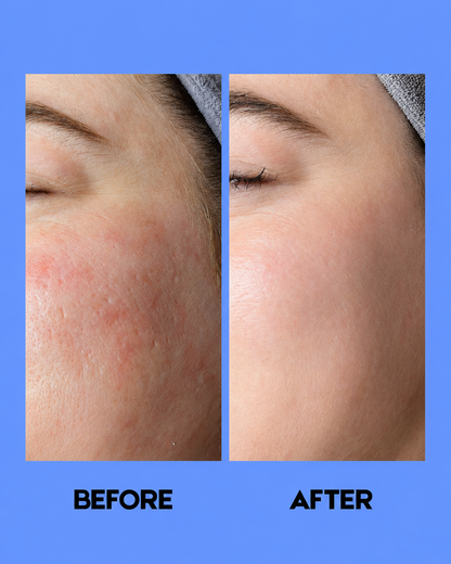 Kojie San Nettoyant et tonique éclaircissant pour la peau – 100 ml – Verhelderende &amp;amp; Hydraterende Huidverzorging – Reinigt Grondig, Verwijdert Onzuiverheden &amp;amp; Egaliseert de Huidtint – Voor een Gladde, Stralende &amp;amp; Gezonde Huid
