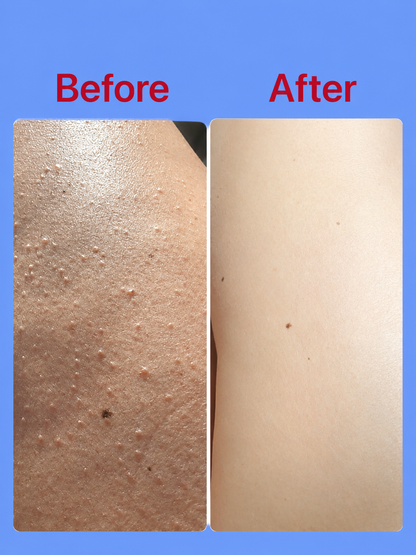 Vaseline Gluta-HYA Serum Burst Lotion UV – 330 ml – Lotion corporelle hydratante et hydratante – Vermindert Donkere Vlekken, Egaliseert de Huidtint &amp;amp; Biedt UV-bescherming – Pour une peau heureuse, stridente et gezonde