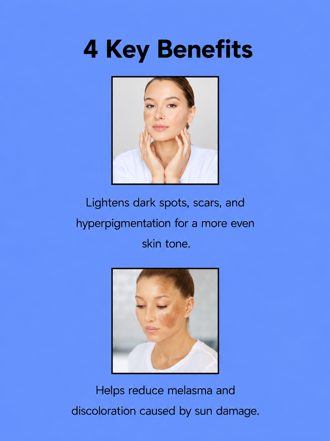 Kojie San 3 × 100 g + Savon hydratant Belo gratuit – Ensemble de soins hydratants et hydratants – Aide à nettoyer, égaliser la teinte d&